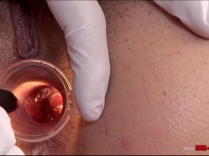 Похотливый врач осмотрел свою пациентку и трахнул ее в пизду